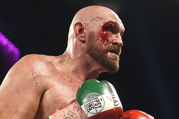 Tyson Fury v Otto Wallin